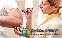 南宁哪家医院治疗白癜风