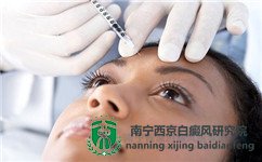 南宁治白癜风的医院哪家好