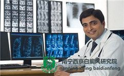 白癜风疾病会不会传染给别人